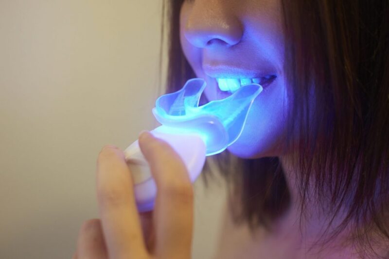 teeth whitening at home and in-office